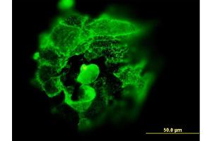 Immunofluorescence of monoclonal antibody to TP53 on A-431 cell.