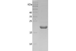 Western Blotting (WB) image for Cofilin 1 (CFL1) (AA 2-166) protein (His tag) (ABIN7122422)