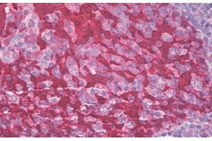 Image no. 1 for anti-Stratifin (SFN) (AA 120-170) antibody (ABIN1490876)