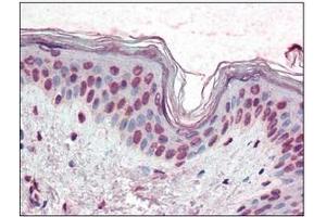 Immunohistochemistry (IHC) image for anti-X-Box Binding Protein 1 (XBP1) (AA 2-160) antibody (ABIN492538) (XBP1 anticorps  (AA 2-160))