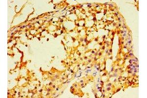Immunohistochemistry of paraffin-embedded human testis tissue using ABIN7152225 at dilution of 1:100 (ECSIT anticorps  (AA 185-431))