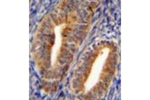 Formalin fixed and paraffin embedded human uterus tissue reacted with DPP3 Antibody (C-term) followed by peroxidase conjugation of the secondary antibody and DAB staining.