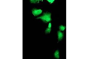 Anti-FBXO21 mouse monoclonal antibody (ABIN2455368) immunofluorescent staining of COS7 cells transiently transfected by pCMV6-ENTRY FBXO21 (RC223095). (FBXO21 anticorps)