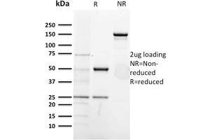 SDS-PAGE AnalysisPurified CD5-Monospecific Mouse Monoclonal Antibody (CD5/2418). (CD5 anticorps  (AA 269-366))