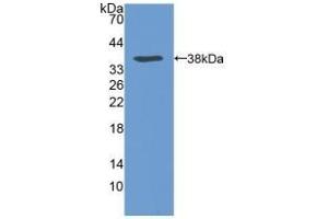 Detection of Recombinant VLDLR, Human using Polyclonal Antibody to Very Low Density Lipoprotein Receptor (VLDLR) (VLDLR anticorps  (AA 418-722))