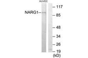 Western blot analysis of extracts from HuvEc cells, using NARG1 Antibody. (NAA15 anticorps  (AA 221-270))