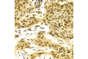 Immunohistochemistry (IHC) image for anti-ELAV (Embryonic Lethal, Abnormal Vision, Drosophila)-Like 1 (Hu Antigen R) (ELAVL1) (AA 1-326) antibody (ABIN3022231)