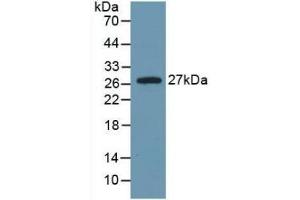 Detection of Recombinant IL6, Rat using Monoclonal Antibody to Interleukin 6 (IL6) (IL-6 anticorps  (AA 25-211))