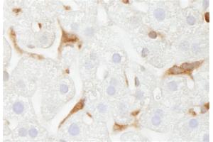 Immunohistochemistry (IHC) image for anti-Glucose-6-Phosphate Dehydrogenase (G6PD) (AA 50-100) antibody (ABIN7448574) (Glucose-6-Phosphate Dehydrogenase anticorps  (AA 50-100))
