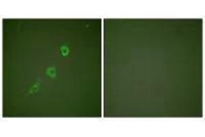 Immunofluorescence analysis of NIH/3T3 cells, using HSP10 antibody. (HSPE1 anticorps)