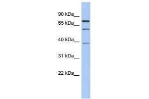 MOSPD2 antibody used at 1 ug/ml to detect target protein.