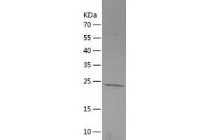 Western Blotting (WB) image for Unc-51 Like Kinase 1 (ULK1) (AA 400-599) protein (His tag) (ABIN7125654)