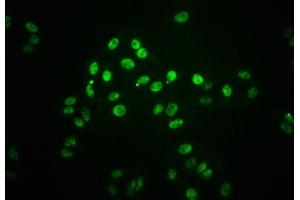 Immunofluorescence staining of HepG2 cells(treated with 100 mM Calyculin A for 30 min) with ABIN7127753 at 1:66,counter-stained with DAPI. (Recombinant STAT1 anticorps  (pSer727))