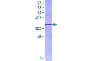 Image no. 1 for Inositol 1,4,5-Trisphosphate Receptor, Type 1 (ITPR1) (AA 2470-2577) protein (GST tag) (ABIN1308255)