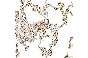 Immunohistochemistry of paraffin-embedded rat lung using Cullin 1 Rabbit pAb (ABIN3015863, ABIN3015864, ABIN3015865 and ABIN6219345) at dilution of 1:50 (40x lens).