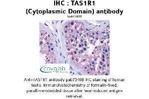 Image no. 1 for anti-Taste Receptor, Type 1, Member 1 (TAS1R1) (3rd Cytoplasmic Domain) antibody (ABIN1739914) (TAS1R1 anticorps  (3rd Cytoplasmic Domain))