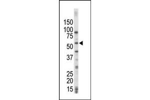 Image no. 1 for anti-Mitogen-Activated Protein Kinase Kinase Kinase 8 (MAP3K8) (C-Term) antibody (ABIN360360) (MAP3K8 anticorps  (C-Term))