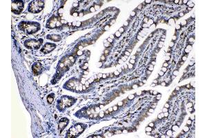 IHC analysis of Caspase8 using anti-Caspase8 antibody .