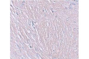 Immunohistochemistry of SYNPO in human brain tissue with SYNPO Antibody  at 2. (SYNPO anticorps  (C-Term))