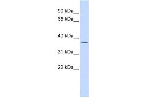 WB Suggested Anti-PAntibody Titration:  0. (PARP16 anticorps  (Middle Region))