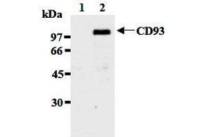 Western Blotting (WB) image for anti-CD93 (CD93) antibody (ABIN1449221)