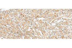 anti-GIPC PDZ Domain Containing Family, Member 1 (GIPC1) antibody