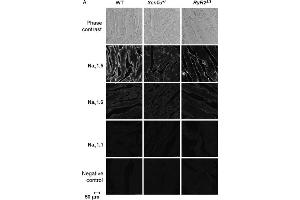 Decreased expression of NaV1.