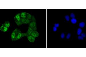 Immunofluorescence analysis of HeLa cells using CREB1 antibody (ABIN5996963). (CREB1 anticorps)