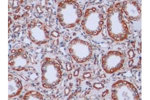 Detection of VIM in Human Kidney Tissue using Monoclonal Antibody to Vimentin (VIM)