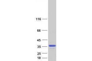 Validation with Western Blot