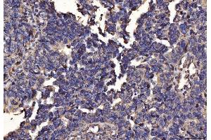IHC analysis of PDIA6 using anti-PDIA6 antibody (ABIN7600554). (PDIA6 anticorps  (AA 20-440))