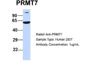 Host:  Rabbit  Target Name:  PRMT7  Sample Type:  Human 293T  Antibody Dilution:  1. (PRMT7 anticorps  (N-Term))