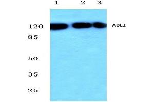Western blot analysis of c-Abl antibody at 1/500 dilution in HepG2 whole cell lysate (Lane 1), Mouse (Lane 2) and Rat (Lane 3) liver tissue lysates. (ABL1 anticorps)