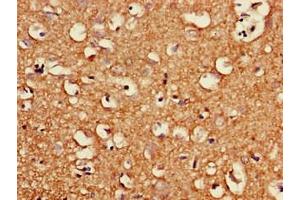 Immunohistochemistry of paraffin-embedded human brain tissue using ABIN7163987 at dilution of 1:100 (KCNG4 anticorps  (AA 1-218))