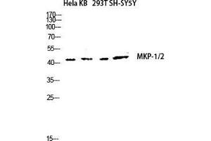Western Blot (WB) analysis of HeLa KB 293T SH-SY5Y lysis using MKP-1/2 antibody. (MKP-1/2 anticorps  (Lys92))