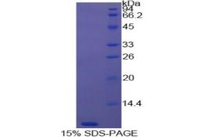 SDS-PAGE analysis of Cow Thymosin beta 4 Protein. (TMSB4X Protéine)