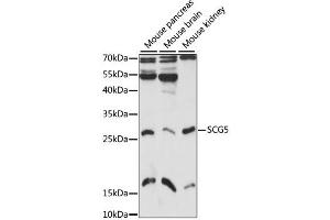 Western blot analysis of extracts of various cell lines, using SCG5 antibody (ABIN6293598) at 1:1000 dilution. (SCG5 anticorps)