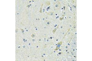 Immunohistochemistry of paraffin-embedded mouse spinal cord using SLC1A4 antibody. (SLC1A4 anticorps  (AA 140-220))