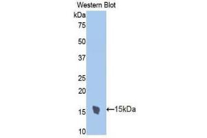 Western Blotting (WB) image for anti-Trefoil Factor 2 (TFF2) (AA 27-129) antibody (ABIN1173513) (Trefoil Factor 2 anticorps  (AA 27-129))