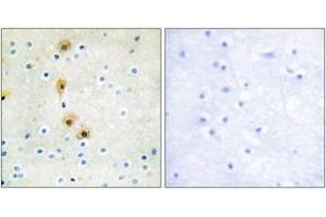Immunohistochemistry (IHC) image for anti-V-Akt Murine Thymoma Viral Oncogene Homolog 1 (AKT1) (AA 292-341) antibody (ABIN2888779) (AKT1 anticorps  (AA 292-341))