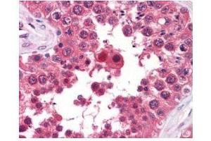 anti-AHA1 monoclonal antibody was used at a 5-10 µg/mL to detect AHA1 in the seminiferous tubule of human testis (40X) showing moderate staining.