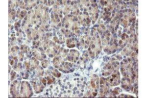 Image no. 1 for anti-Phosphoinositide-3-Kinase, Regulatory Subunit 5 (PIK3R5) antibody (ABIN1500214) (PIK3R5 anticorps)