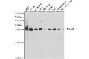 Western blot analysis of extracts of various cell lines using PSMA2 Polyclonal Antibody at dilution of 1:1000. (PSMA2 anticorps)
