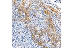 Immunohistochemistry of paraffin-embedded Human tonsil using δ-Catenin/p120 Catenin antibody (ABIN7266144) at dilution of 1:500 (40x lens). (CTNND1 anticorps)