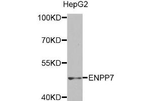 Western blot analysis of extracts of HepG2 cell line, using ENPP7 antibody. (ENPP7 anticorps)