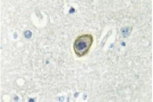 Image no. 1 for anti-Colony Stimulating Factor 1 Receptor (CSF1R) antibody (ABIN317788) (CSF1R anticorps)