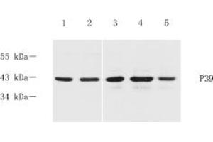 Western blot analysis of p39 (ABIN7074968) at dilution of 1: 600,Lane 1: Mouse brain tissue lysate,Lane 2: Mouse cerebral cortex tissue lysate,Lane 3: Rat brain tissue lysate,Lane 4: Rat cerebral cortex tissue lysate,Lane 5: Rat hippocampus tissue lysate (p39 anticorps)