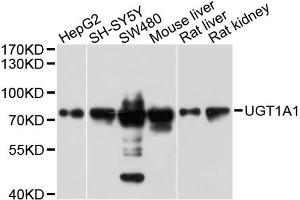 Western blot analysis of extracts of various cell lines, using UGT1A1 antibody. (UGT1A1 anticorps)