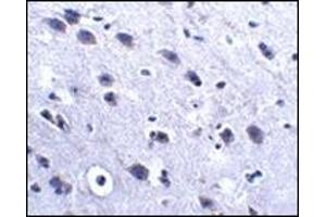 Immunohistochemistry of LRFN2 in mouse brain tissue with this product at 2.