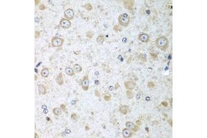 Immunohistochemistry of paraffin-embedded mouse brain using TRH antibody at dilution of 1:100 (40x lens).